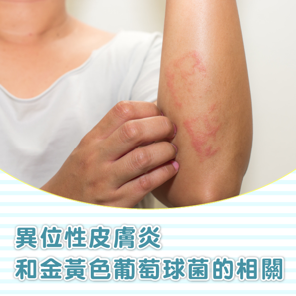 異位性皮膚炎和金黃色葡萄球菌的相關